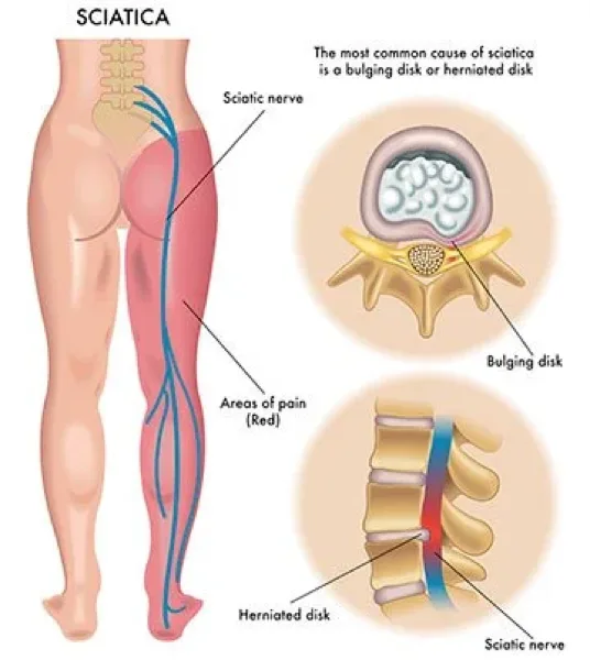Chiropractic care helps seniors stay active